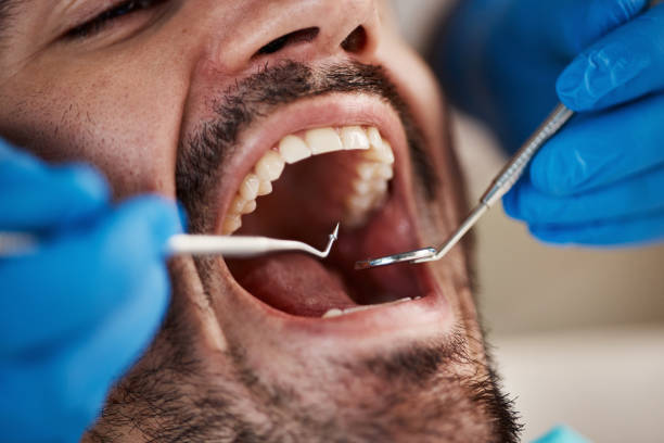 Emergency Dental Services in Ballenger Creek, MD
